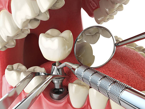 Best Cracked Tooth Emergency Dentist  in Frederic, WI