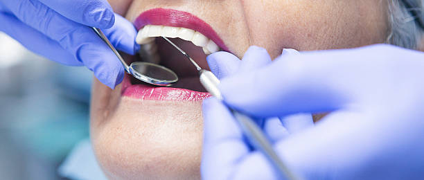 Best Teeth Whitening  in Frederic, WI